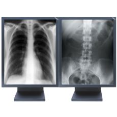 Medical Monitors